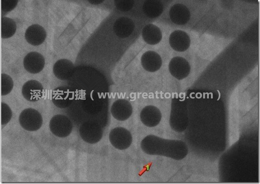 BGA因?yàn)楹笁|變小，造成錫膏過多而最終形成焊接短路的結(jié)果。